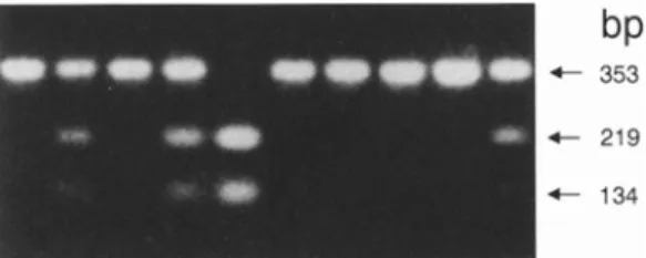 Fig.  2.  Detection of a polymorphic  MspI  site at the 3' side of the  MYOG  gene in eight Great Yorkshire (GY) boars