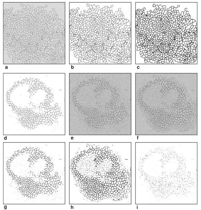 Fig. 7 Segmentation of synthetic wing discs. a–c Maximum-intensity projections of (a) the synthetic noisy, blurred image, (b) the  recon-struction by joint deconvolution/segmentation ( λ = 0 