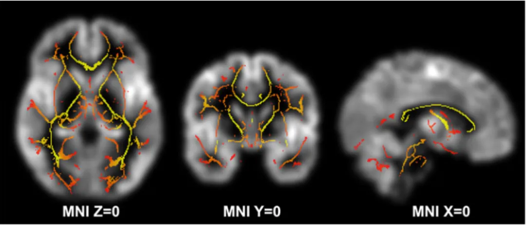 Fig. 1 Illustrates the group average grey matter (greyscale) and white matter FA skeleton (red–yellow) in MNI standard space centered at MNI X = 0, Y = 0, Z = 0