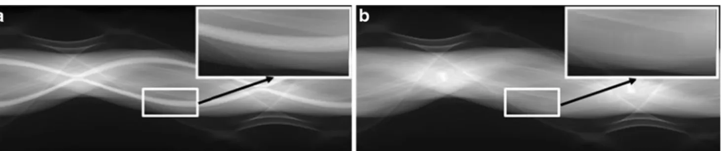 Fig. 11 Bland-Altman plots generated from uncorrected and corrected PET images of the 30 clinical studies