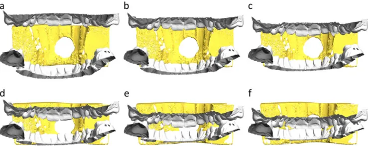 Fig. 4 A 3D comparison of the bite mark in the apple with the dentitions of the suspected biters using ATOS software