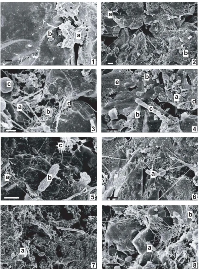 Figure 5. Scanning electron micrographs of sediment from the slow sand fi lters (top layer): C– fi lters (odd numbers) and C+ fi lters (even  numbers)