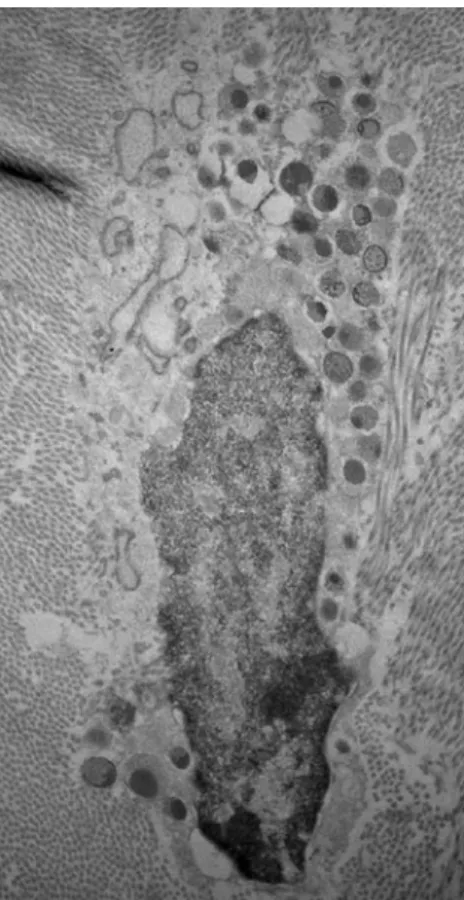 Fig. 3 Transmission electron micrography of a sample obtained from a hip joint capsule