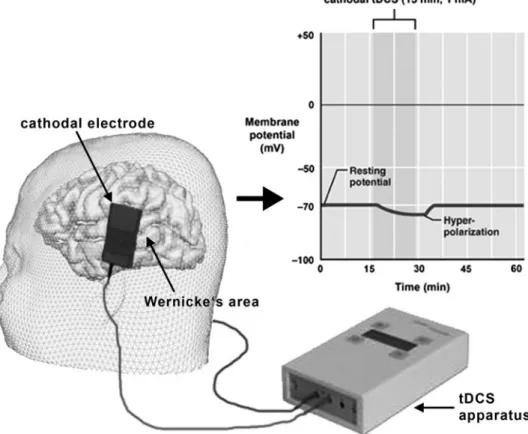 Fig. 2 Cathodal (negative) transcranial direct current stimulation (tDCS) supposedly causes hyperpolarization at Wernicke’s area
