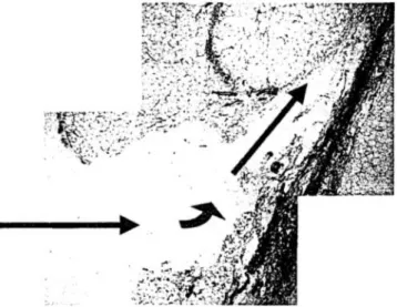 Fig.  1.  Jet deviation  by  stronger  structures  as  septa  in  the fizt. 