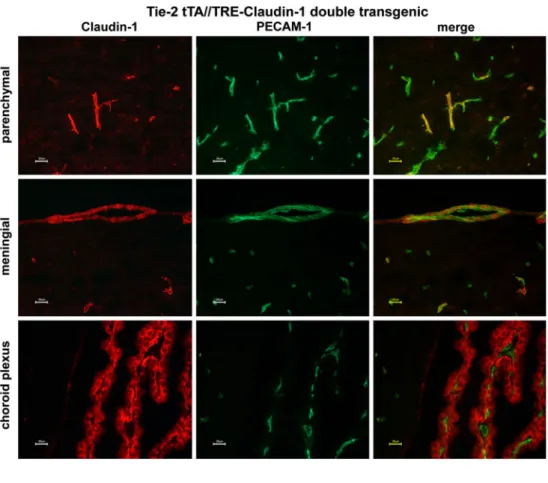 Fig. 2 Expression of claudin-1 in the brains of Tie-2  tTA//TRE-claudin-1 double and single transgenic mice.