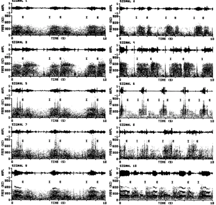 Fig.  2  Representative  sections  of 10 s of the ten signals  used in the evaluation  study