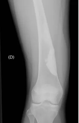 Fig. 13 Thirty-nine months after the second surgical procedure, the situation appeared stabilized