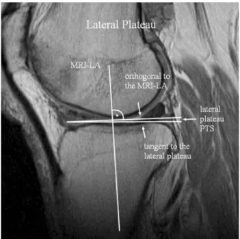 Fig. 3 The image shows the center of the lateral tibial plateau with the preserved longitudinal axis (LA) determined on the central sagittal slice