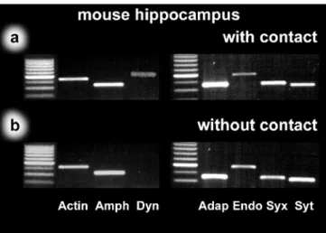 Fig. 4 Differential appearance of dynamin isoforms in mouse hip- hip-pocampus ( lane 1 size marker)