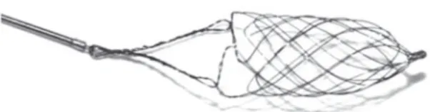 Abbildung 3. Das  Catch-Device besteht  aus einem  selbstex-pandierenden  Nitinol-geflecht