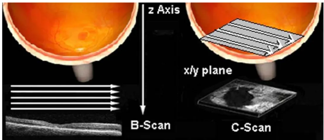 Fig. 2 Multiplanar imaging by combining optical coherence tomog- tomog-raphy (OCT) and scanning laser ophthalmoscopy (SLO)