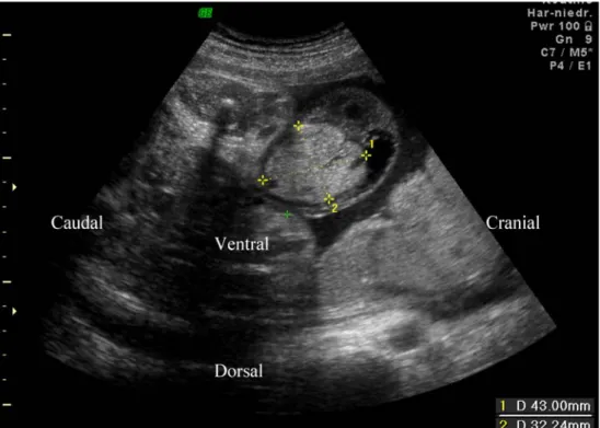 Fig. 3 Cross-section of umbilical cord showing an umbilical artery (a). Note the abundance of tiny capillaries around the artery (thick arrow)