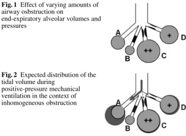 Fig. 1 Effect of varying amounts of airway osbstruction on