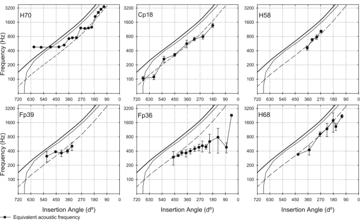 FIG. 6. Equivalent acoustic frequency versus electrode insertion angle for all six subjects