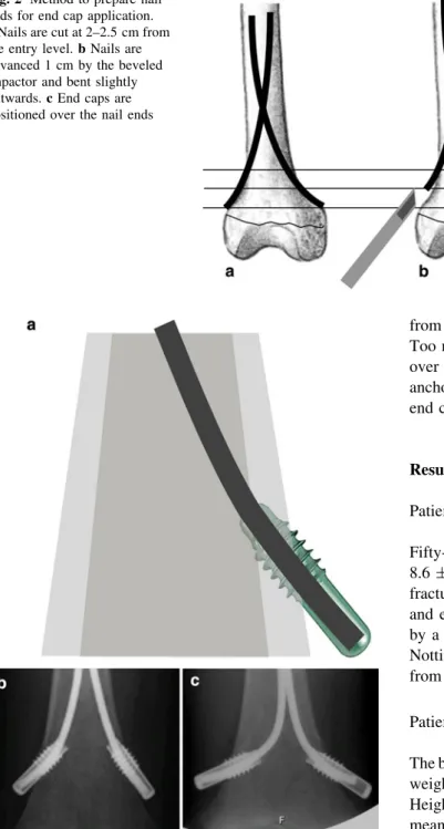 Fig. 2 Method to prepare nail ends for end cap application.