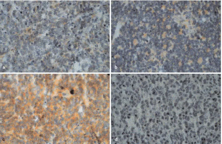 Fig. 5 Example of an EGFR-positive tumor: FISH analysis showed no gene amplification (100-fold magnification)