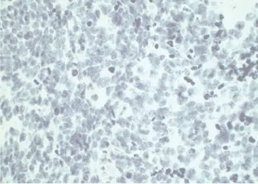 Fig. 6 A tumor negative for HER-2 (40-fold magnification)