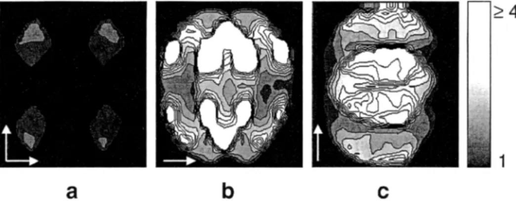 Fig. 5. Geometry factors in the in vivo experiment. The results are calculated with voxel exclusion based on measured coil sensitivities and shown  l;ar a central axial slice