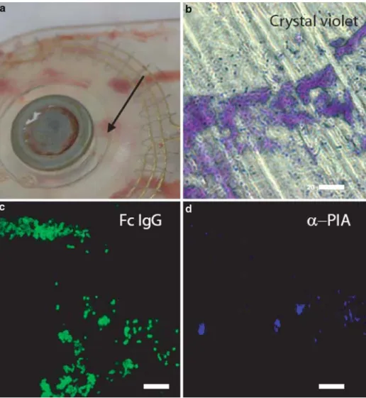 Figure 1. Microscopy imaging of the removed cochlear implant. a) Magnet pocket of the explanted Clarion 90 K cochlear implant