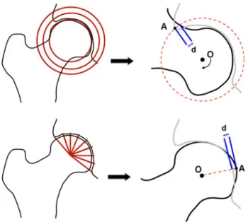 Fig. 2 Upper-left: cylindrical segmentation of the space around the hip joint. Upper-right: angular penetration depth obtained by cylindrical segmenting method