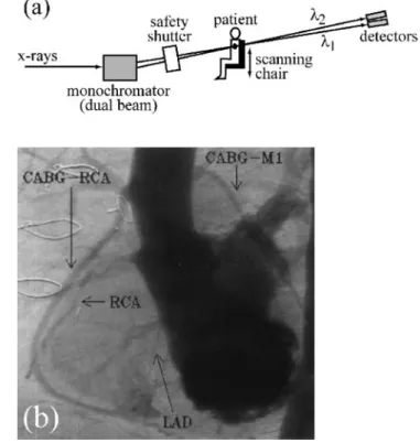 Fig. 3 a Scheme of a system for digital subtraction angiography performed with the dichromography approach (see [8, 9])