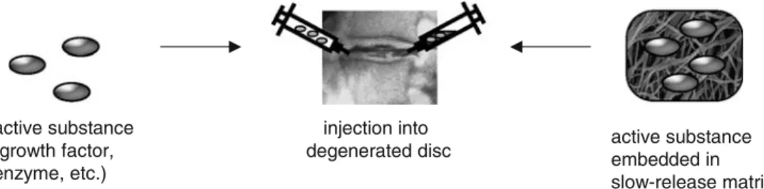 Fig. 3 Direct injection of an active substance into the interver- interver-tebral disc matrix