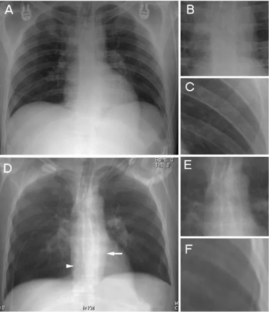 Table 1 summarizes the results for visualization of critical anatomical landmarks using CR and thick MPR