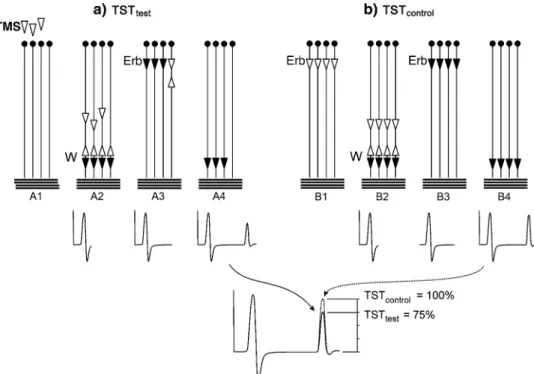 Fig. 1 Triple stimulation technique (TST) principle, recording from abductor digiti minimi (ADM)