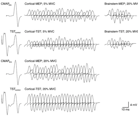 Table 2 Experiment I: response variability of MEP and TST amplitudes in M. abductor digiti minimi