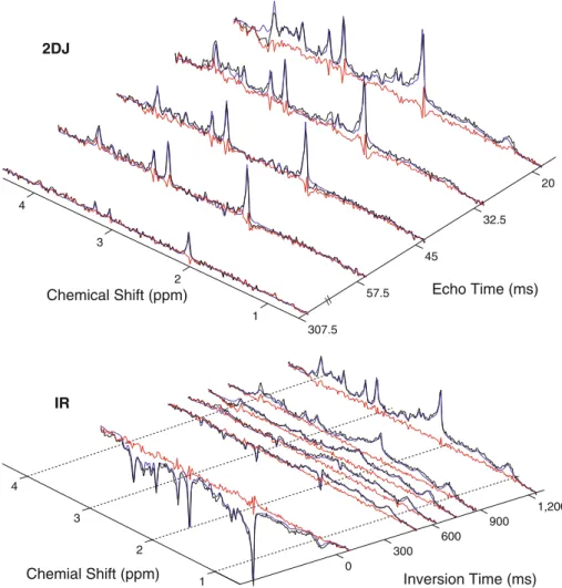 Fig. 7 Representative experimental 2DJ and IR in vivo spectra and corresponding fit and residues