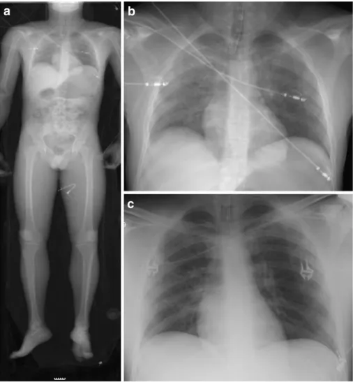 Fig. 2 A 12-year-old male pa- pa-tient after a motor-vehicle  acci-dent. b Image extracted from the magnified full-body LSDR (a).
