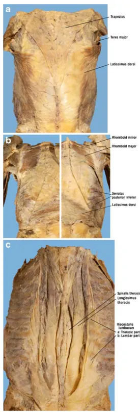 Fig. 2 Overview of the posterior trunk. a Superficial muscular layer of the trapezius, the teres major, and both latissimus dorsi muscles.