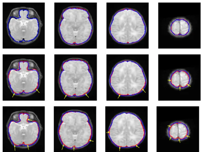 Figure 8 shows the average DM values for test datasets when different numbers of training volumes are used to