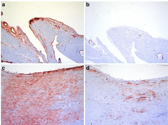 Fig. 3 Hanging (Table 3, case 5). a Fibronectin, RV, grade 0.