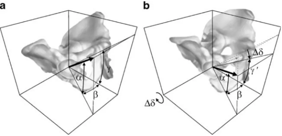 Fig. 6 The definitions of cup version (α), cup abduction (β), and the cup version angle that is projected onto the body ’ s mid plane ( γ ), are shown (a)