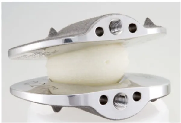 Fig. 1 The image shows the Dynardi implant (Ó 2009 Zimmer GmbH, Winterthur, Switzerland) consisting of two metal plates and a polyethylene insert