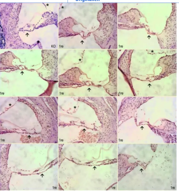 Abb. 5  8  Nach Transplantation von neurogenen Vorläuferzellen in vivo zeigt sich in der HE-Färbung im Innenohr kein entzündliches Infiltrat