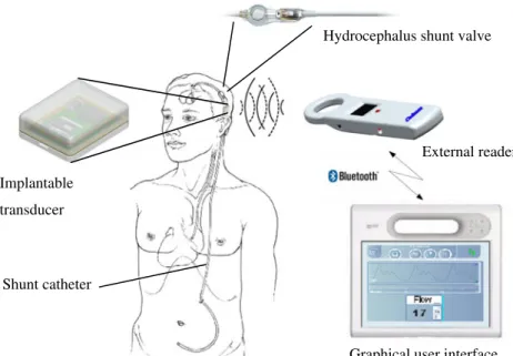 Fig. 2 Components of the implantable calorimetric flow transducer.