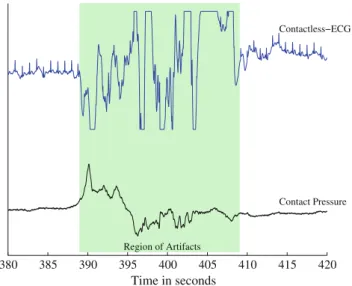 Fig. 8 Example of movement artifacts occurring on the EDA signal