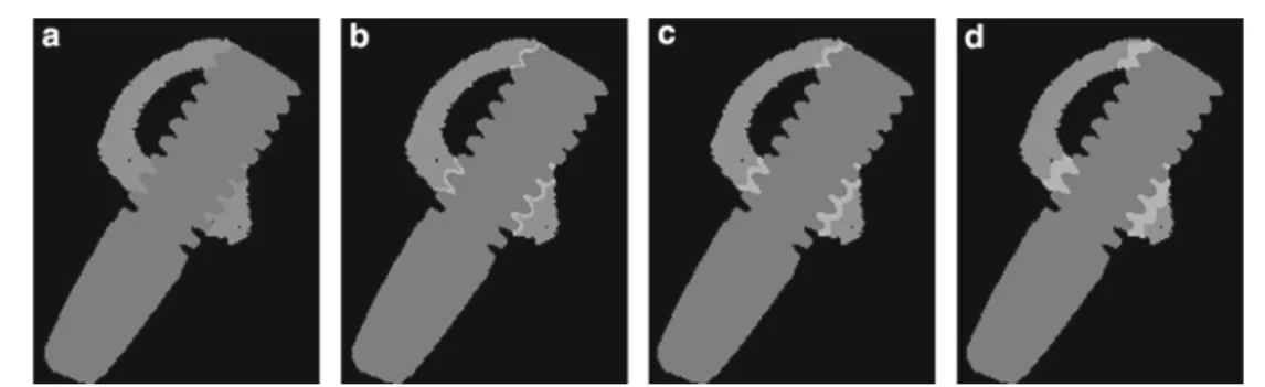 Fig. 2 Four models corresponding to four representations of the bone- bone-implant interface were created