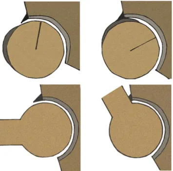 Fig. 1 Top: Reduced head-neck offset of cam FAI: non-spherical head abuts the acetabular rim