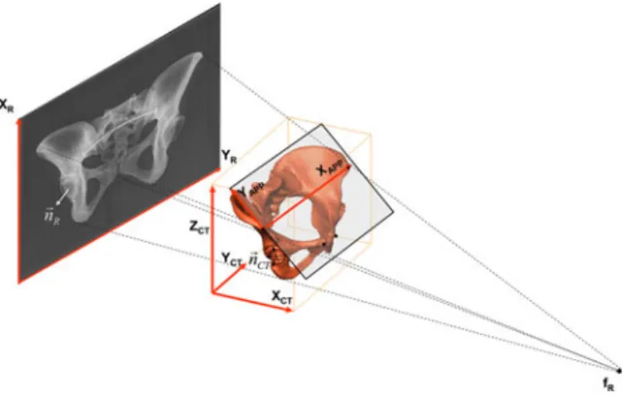 Fig. 1 Schematic illustration of using 2D–3D registration to determine the post-operative cup orientation from single X-ray radiograph