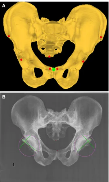 Fig. 2 Anatomical landmarks extracted from the CT data and the X-ray radiograph. (a) Landmarks extracted from the CT data; and (b) Landmarks extracted from the X-ray radiographs
