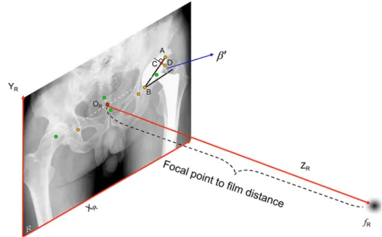 Fig. 3 Schematic view of the X-ray coordinate system construction and the cone-beam projection model establishment (see text for details)