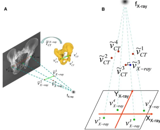 Fig. 4 Schematic view of the iterative landmark-to-ray 2D–3D registration.