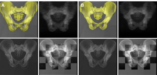 Fig. 5 Screenshots of applying the hybrid 2D–3D registration scheme to a cadaver dataset