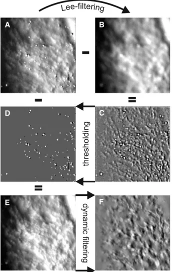 Fig. 5 Preprocessing. a Frame from a raw reflectometry movie. b Smoothed, Lee-filtered image
