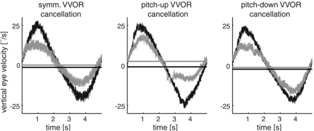Fig. 3 Median vertical eye velocity traces (deg/s, positive values indicate upward directed eye velocity) of one typical subject (S.M.) during VVOR assessment in complete darkness before (black traces) and after (gray traces) symmetric visual VVOR cancella