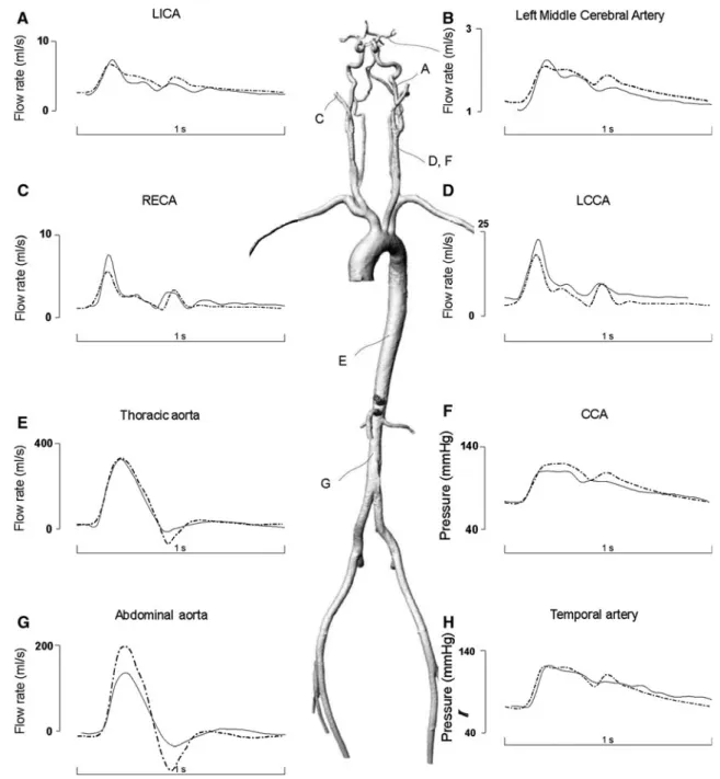 Fig. 2 Adapted from [35]. 1-D model predictions (dash dot) compared to in vivo measurements of flow and pressure waves (continuous line) for different systemic and cerebral arteries